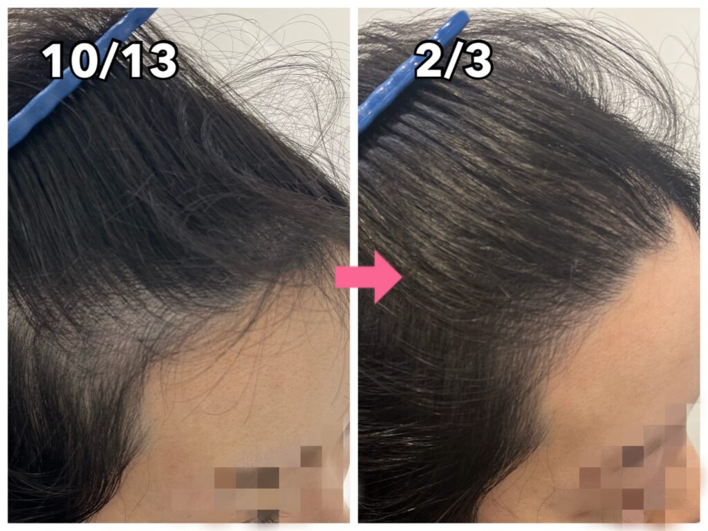 Iさんの改善事例